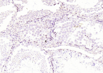 RelB Rabbit Polyclonal Antibody