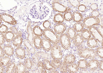 RelB Rabbit Polyclonal Antibody