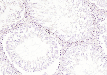 RelB Rabbit Polyclonal Antibody