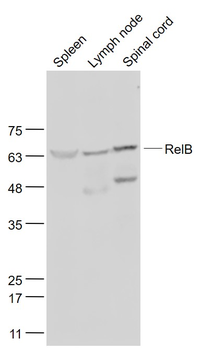 RelB Rabbit Polyclonal Antibody