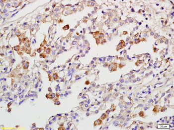 RIPK3 Rabbit Polyclonal Antibody