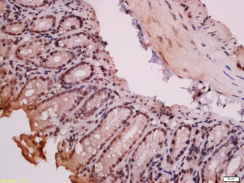 RORC Rabbit Polyclonal Antibody