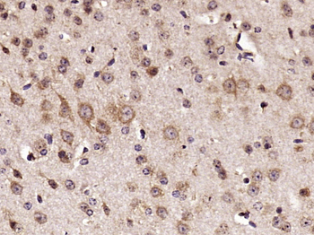 RPS6 Rabbit Polyclonal Antibody