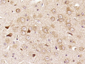 RPS6 Rabbit Polyclonal Antibody