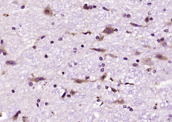 Phospho-RPS6 (Ser240 + Ser244) Rabbit Polyclonal Antibody