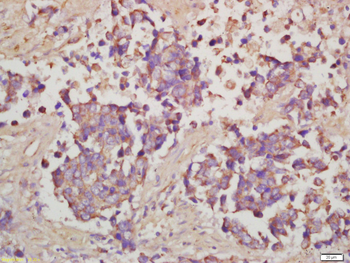 Phospho-RPS6 (Ser240 + Ser244) Rabbit Polyclonal Antibody