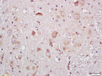 Phospho-RPS6 (Ser240 + Ser244) Rabbit Polyclonal Antibody