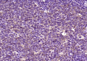 Phospho-RSK2 (Ser227) Rabbit Polyclonal Antibody