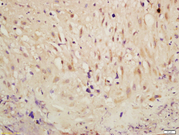 Phospho-RSK2 (Ser227) Rabbit Polyclonal Antibody