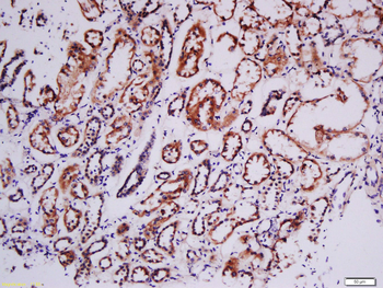 Phospho-RSK2 (Tyr529) Rabbit Polyclonal Antibody