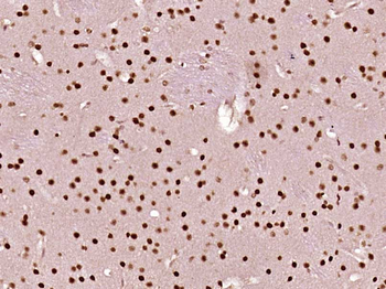 RSK3 Rabbit Polyclonal Antibody