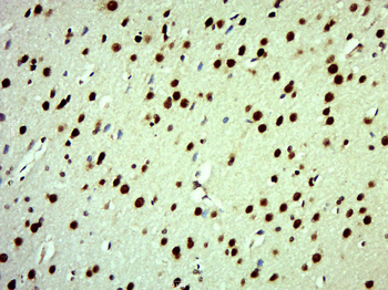 RSK3 Rabbit Polyclonal Antibody