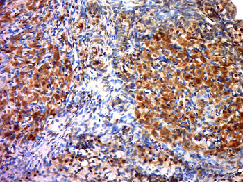 RSK3 Rabbit Polyclonal Antibody