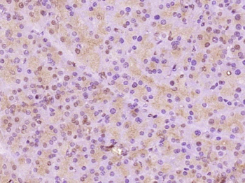 RSK3 Rabbit Polyclonal Antibody