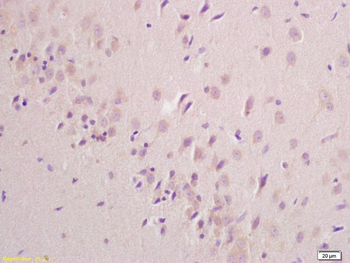 SDHD Rabbit Polyclonal Antibody