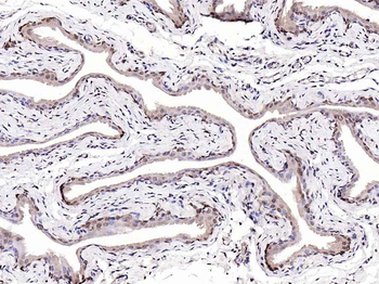 S100A4 Rabbit Polyclonal Antibody