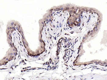 S100A4 Rabbit Polyclonal Antibody