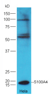 S100A4 Rabbit Polyclonal Antibody