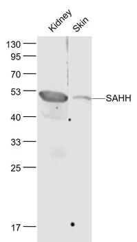 SAHH Rabbit Polyclonal Antibody