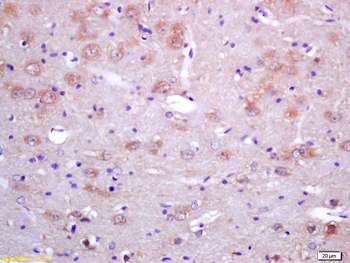 SAHH Rabbit Polyclonal Antibody