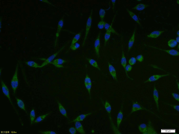 SCD Rabbit Polyclonal Antibody