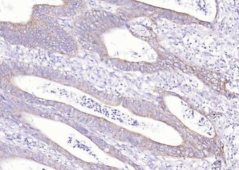 SCD Rabbit Polyclonal Antibody