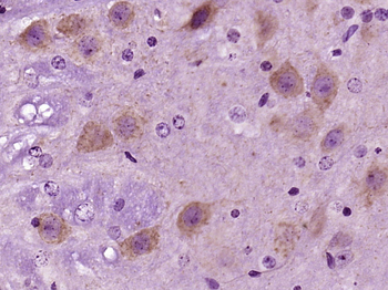 SCD Rabbit Polyclonal Antibody