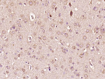 SCD Rabbit Polyclonal Antibody