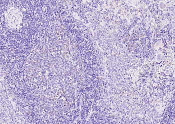 SCD Rabbit Polyclonal Antibody