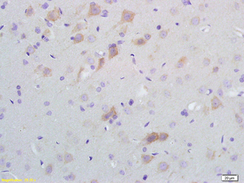 SCD Rabbit Polyclonal Antibody
