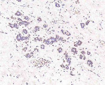 CTDSPL Rabbit Polyclonal Antibody