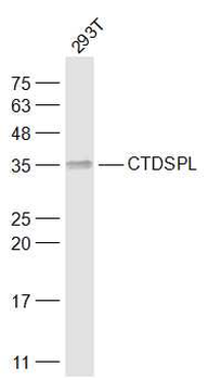 CTDSPL Rabbit Polyclonal Antibody