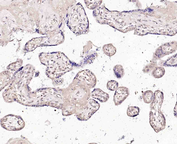 CTDSPL Rabbit Polyclonal Antibody