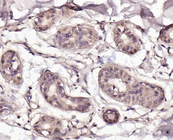 CTDSPL Rabbit Polyclonal Antibody