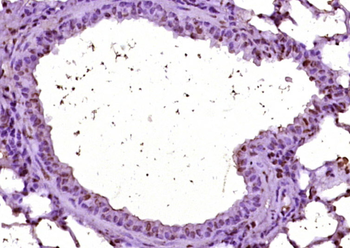 CTDSPL Rabbit Polyclonal Antibody