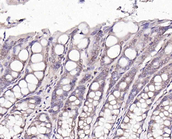 CTDSPL Rabbit Polyclonal Antibody