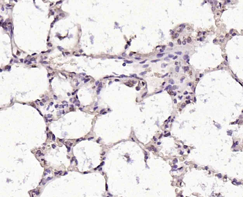 CTDSPL Rabbit Polyclonal Antibody