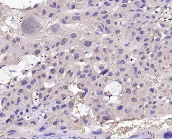 CTDSPL Rabbit Polyclonal Antibody