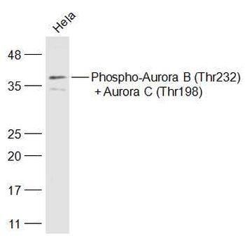Phospho-Aurora B (Thr232) + Aurora C (Thr198) Rabbit Polyclonal Antibody