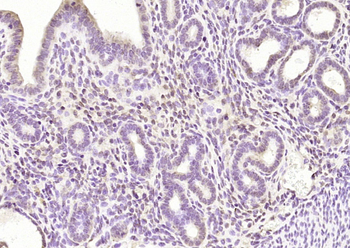 SENP3 Rabbit Polyclonal Antibody