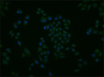 Phospho-SGK1 (Ser78) Rabbit Polyclonal Antibody