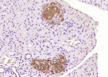 Phospho-SGK1 (Ser78) Rabbit Polyclonal Antibody