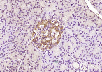 Phospho-SGK1 (Ser78) Rabbit Polyclonal Antibody