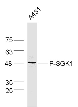 Phospho-SGK1 (Ser78) Rabbit Polyclonal Antibody