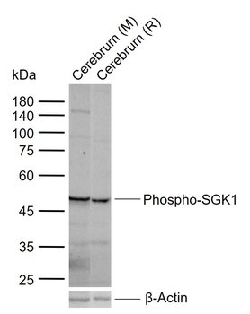 Phospho-SGK1 (Ser78) Rabbit Polyclonal Antibody