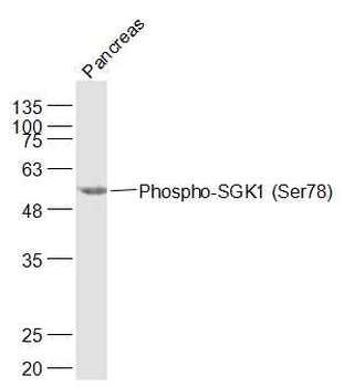 Phospho-SGK1 (Ser78) Rabbit Polyclonal Antibody