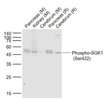 Phospho-SGK1 (Ser422) Rabbit Polyclonal Antibody