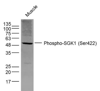 Phospho-SGK1 (Ser422) Rabbit Polyclonal Antibody