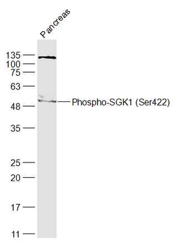 Phospho-SGK1 (Ser422) Rabbit Polyclonal Antibody