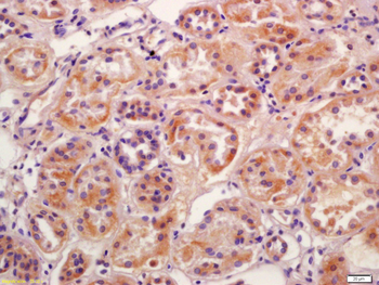 Phospho-SGK1 (Ser422) Rabbit Polyclonal Antibody